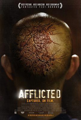 折磨 Afflicted (2013) - 毒蛇电影